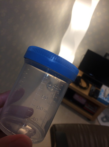 精液検査