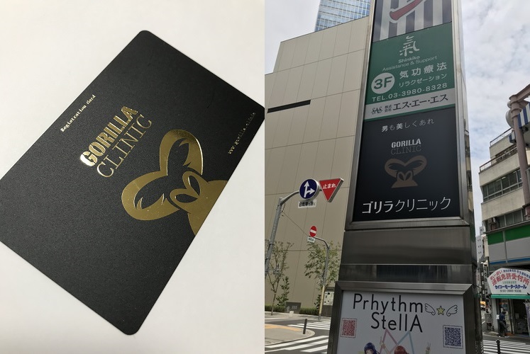 ケツ毛Oライン脱毛体験談
